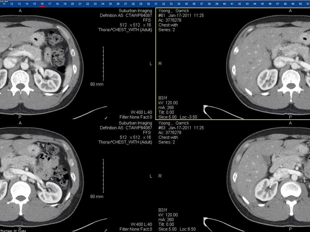 លទ្ធផលសេចក្តីប្រកាស: សេចក្តីណែនាំ និងភាពសំខាន់
